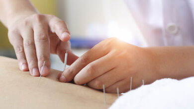 Things You Should Know About Acupuncture For Pain Relief