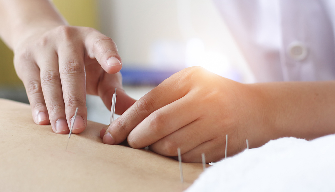 Things You Should Know About Acupuncture For Pain Relief